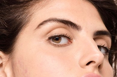 o-que-e-a-acne-hormonal-e-como-uma-rotina-de-cuidados-pode-ajudar