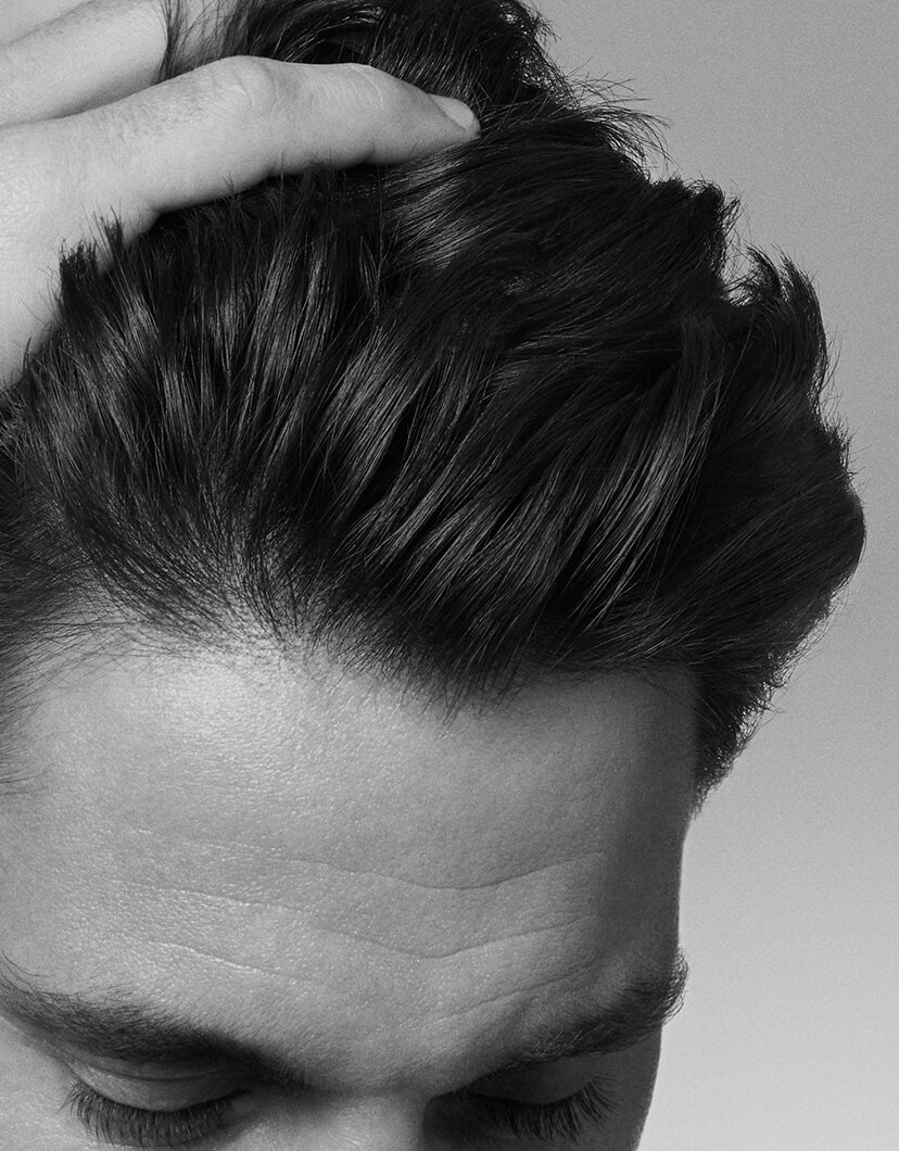 tudo-o-que-voce-precisa-saber-sobre-caspa-aderente