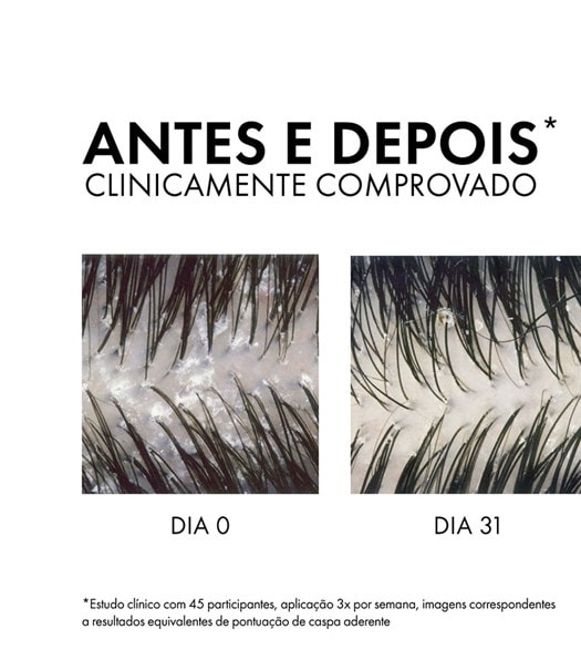 Shampoo AntiCaspa DS Cabelos Normais a Oleosos