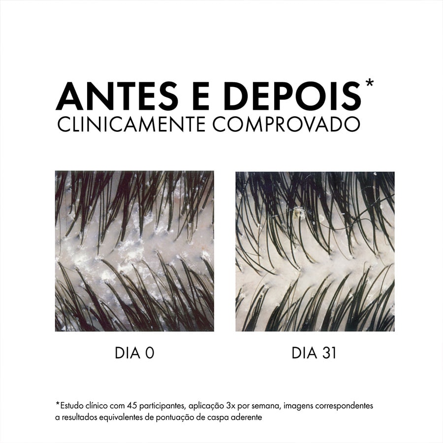 Shampoo Anticaspa Intensivo DS Cabelos Secos