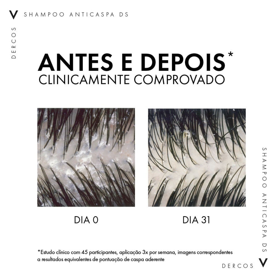 Shampoo Anticaspa DS 125g Secos