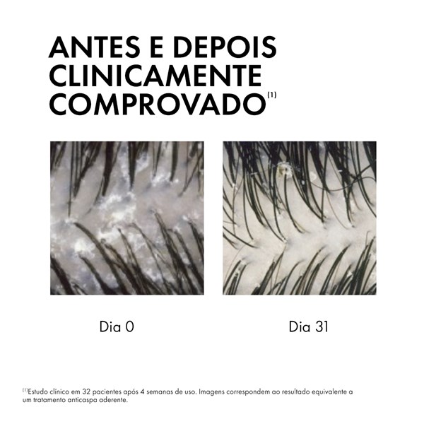 Dercos anticaspa sérum 10