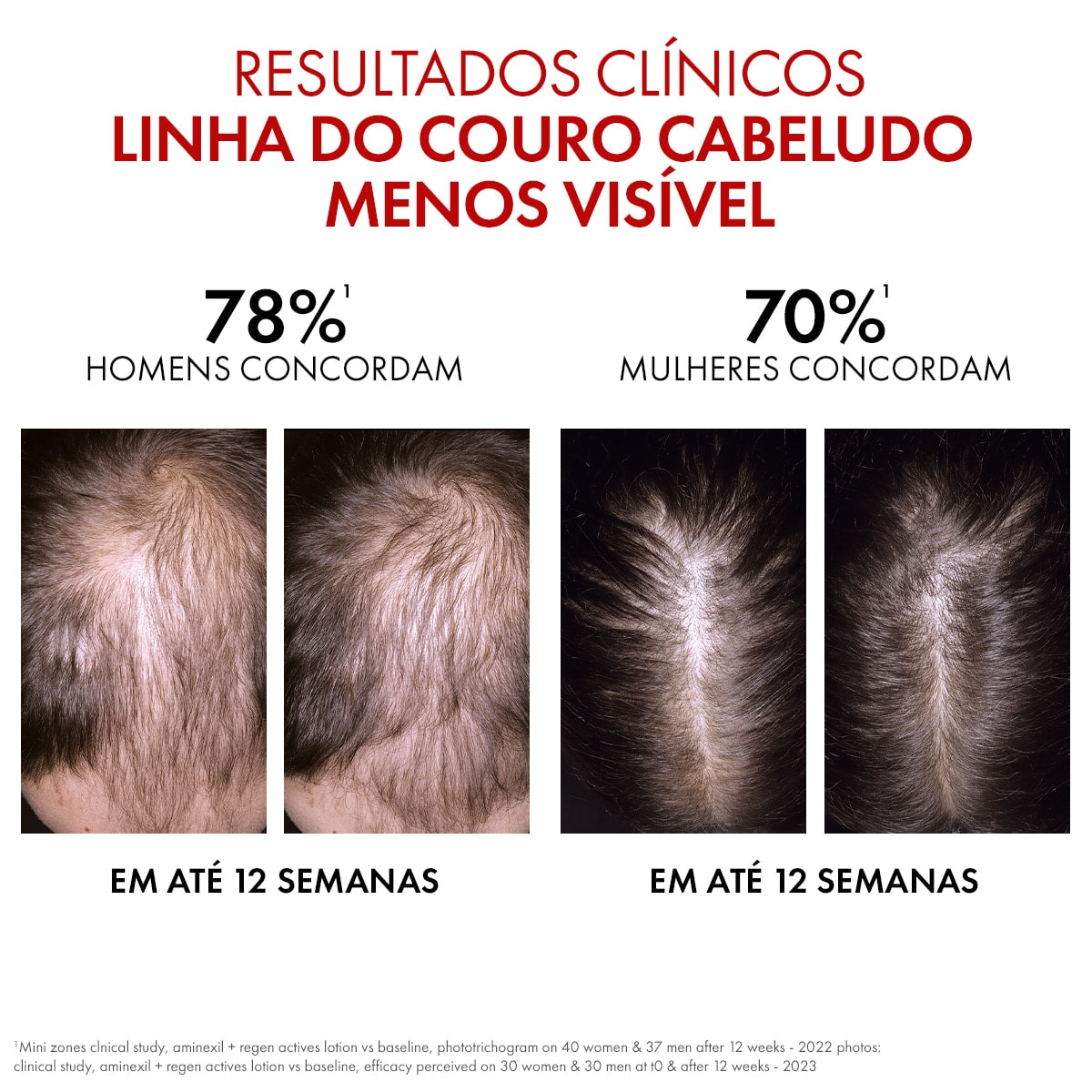 Sérum Renovador Regen Booster