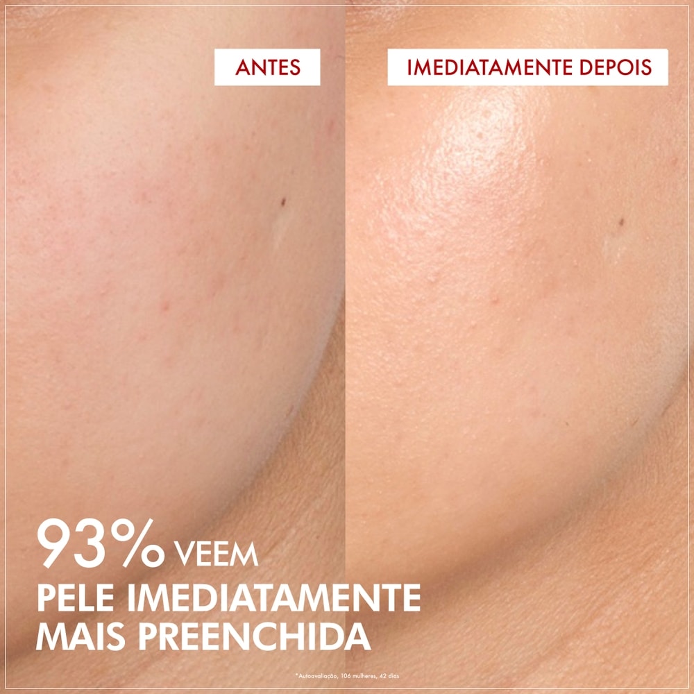 93% veem a pele imediatamente mais preenchida.
