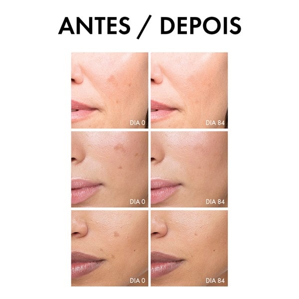 LIFTACTIV Pigment Specialist B3 Serum Antimanchas com Melasyl